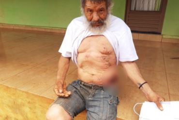 Morador de rua é queimado enquanto dormia em praça no interior de SP