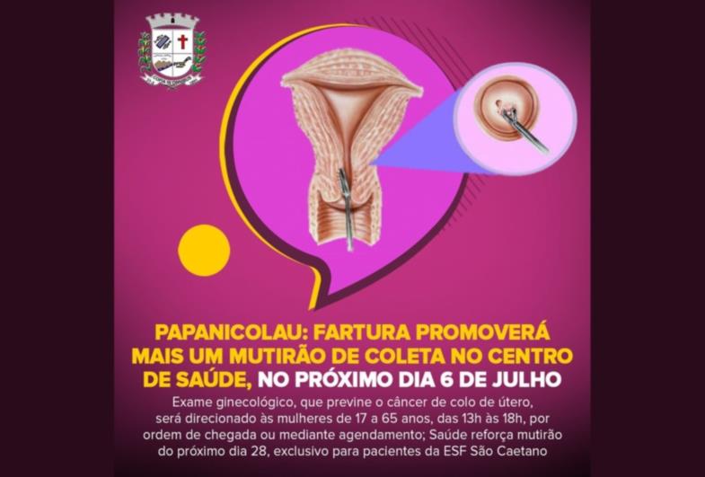 Papanicolau: Fartura promoverá mais um mutirão de coleta no Centro de Saúde, no próximo dia 6 de julho