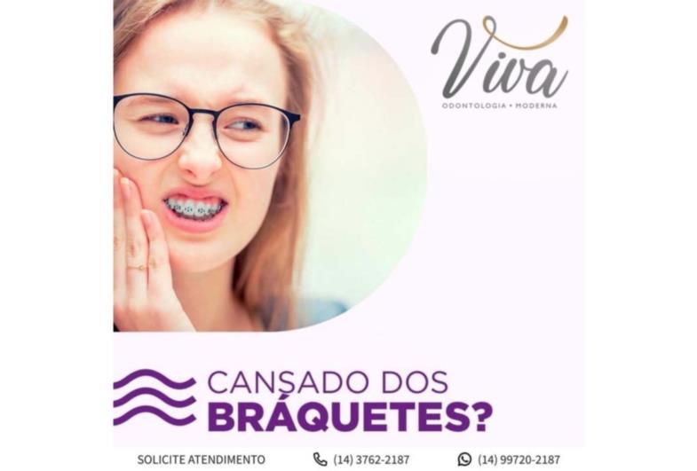 Você está cansado(a) dos braquetes, mas ainda  sonha em ter um sorriso lindo?