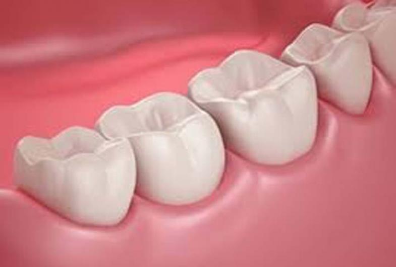 As indicações e possibilidades das restaurações dentárias