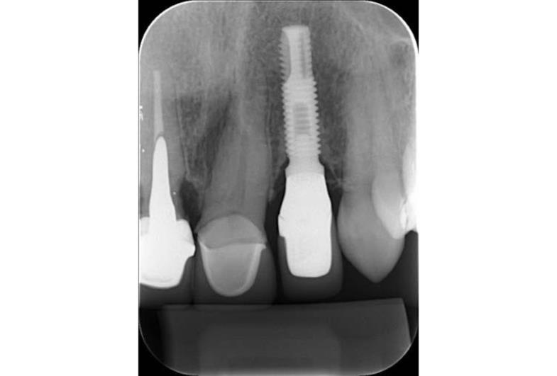 Por que o raio-x é tão usado no tratamento odontológico?