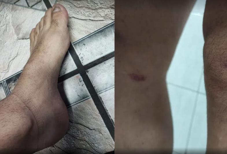 Pai de adolescente espancado ao ser confundido com estuprador: o que se sabe e o que falta saber sobre o caso