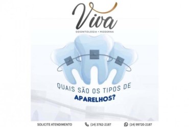 Conheça os principais aparelhos ortodônticos