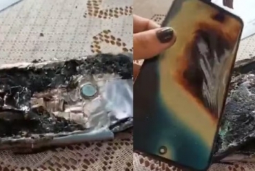 Celular explode no bolso e provoca queimaduras de 3º grau na perna de homem em Avaré