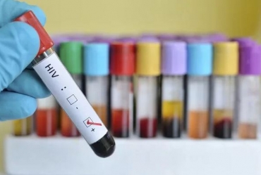 Posto “Celso Negrão” de Avaré oferece testes rápidos de HIV nesta quarta-feira, 20