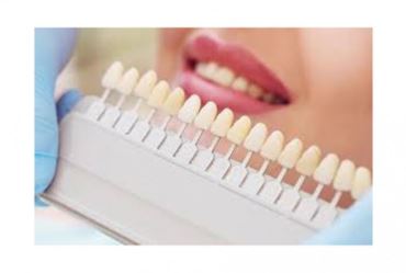 Dúvidas sobre o clareamento dental?